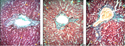 Collagen Fiber Profile in Rat Livers Following Doxorubicin Administration